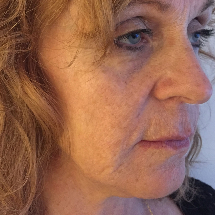 1083efterMarianneOestergaard