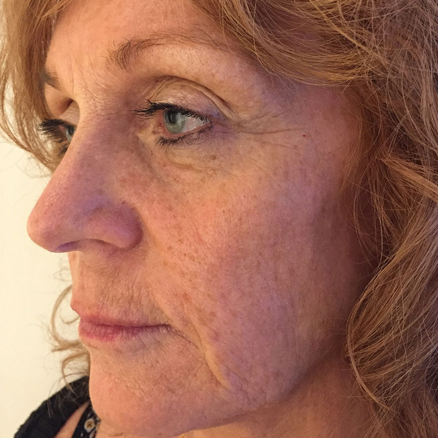 1084efterMarianneOestergaard