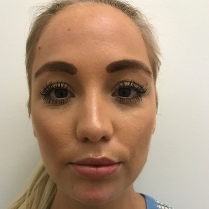 1099efter1mlhage+masteter