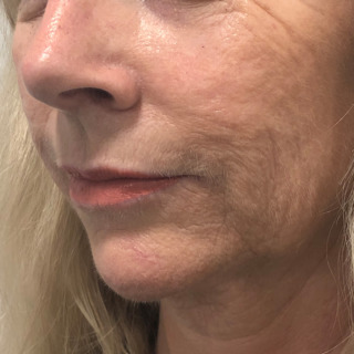 1DorteMarianneJensenEFTER