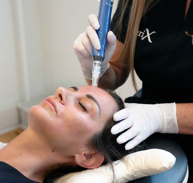Cerix: Nærbillede af en kvinde med lukkede øjne, hvor en behandler i Cerix-tøj med hvide handsker udfører microneedling-ansigtsbehandling på panden med en blå pen. Billedet fokuserer på ansigtet og selve behandlingsøjeblikket i en klinisk setting. Perfekt som illustrativ alt-tekst.