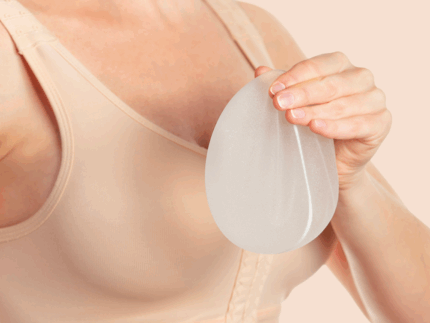 fjernelse-af-brystimplantater-image1 3 (1)