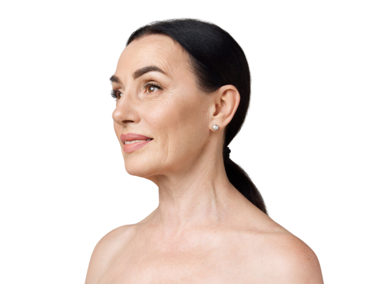 Billede af en moden kvindes ansigt og hals i profil. Hun har naturlige aldringstegn omkring øjne og mund. Hos Cerix tilbydes behandlinger som Botox og fillers til netop disse områder for at reducere rynker og genoprette fylde i huden.