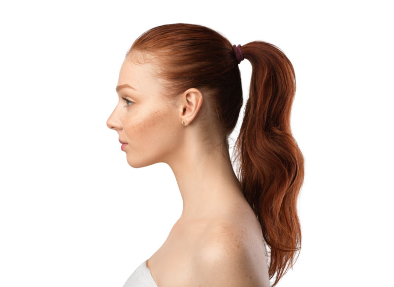 Et profilbillede af en ung kvinde med rødt hår opsat i en hestehale og fregner i ansigtet. Billedet illustrerer fokus på ansigt og hud hos Cerix, hvor man kan få behandlinger som hudpleje, ansigtsbehandlinger eller fillers for at fremhæve ansigtets profil.