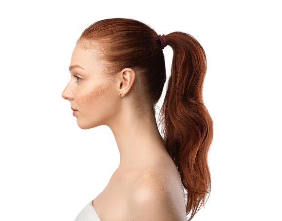 Profilbillede af en kvinde med rødt hår og fregner, der viser en defineret kæbelinje og glat nakke mod en hvid baggrund. Billedet illustrerer æstetiske resultater, der kan opnås hos Cerix gennem behandlinger som fillers til markering af ansigtskonturer eller hudforyngelse i ansigt og på hals.