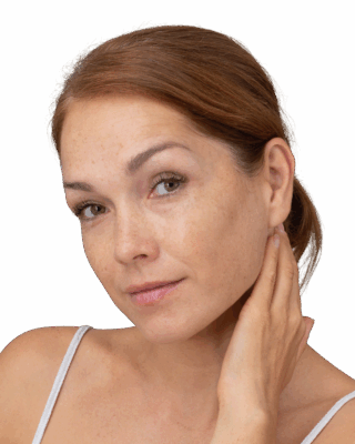 Nærbillede af en kvinde med fregner, der blidt rører sin hals og ser direkte i kameraet. Billedet illustrerer Cerix' ekspertise inden for kosmetiske behandlinger af ansigt og hals, herunder hudforyngelse, fillers eller rynkebehandling, for et naturligt og velplejet udseende.